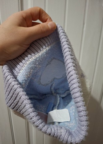 Elsa kız çocuğu bere - Görsel 2