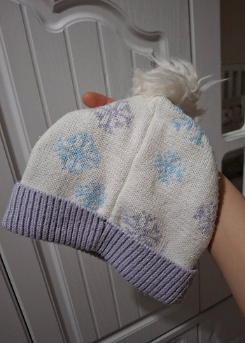 Elsa kız çocuğu bere - Görsel 4