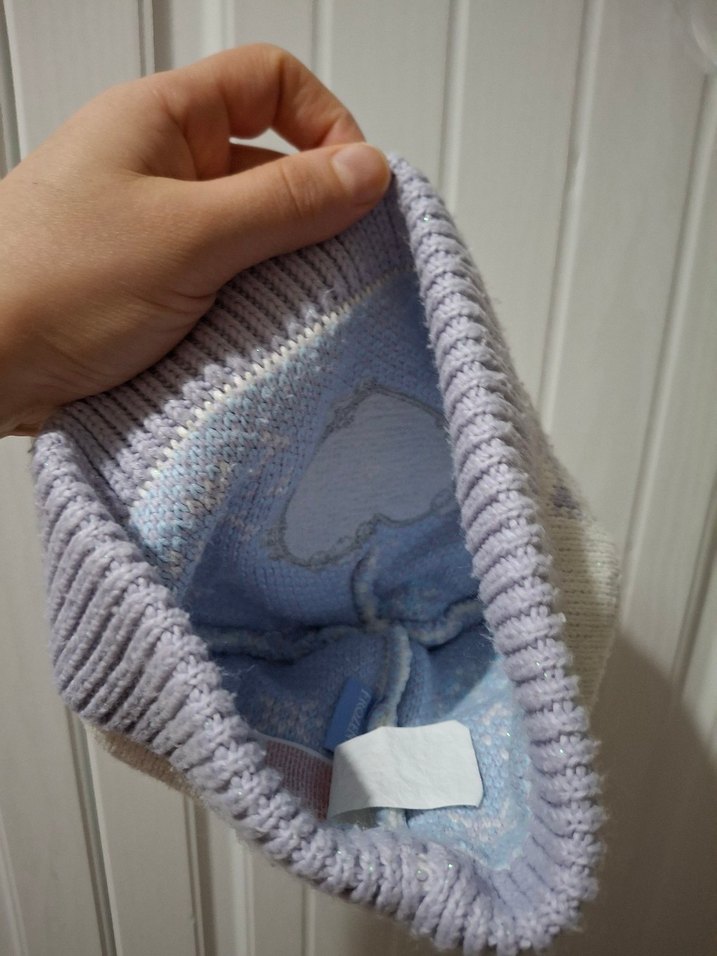 Elsa kız çocuğu bere - Görsel 2