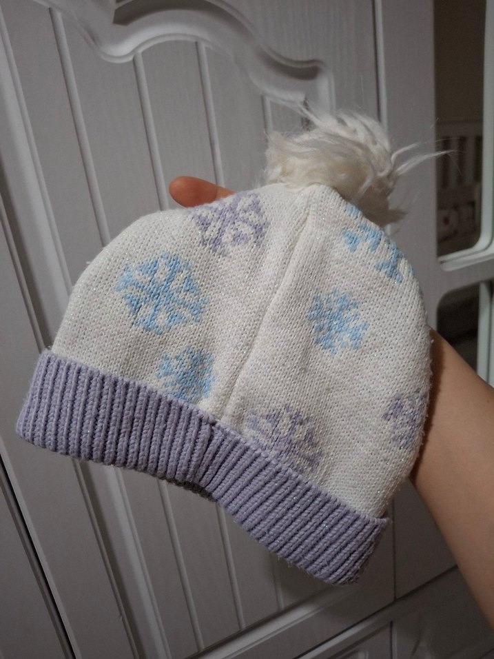 Elsa kız çocuğu bere - Görsel 4