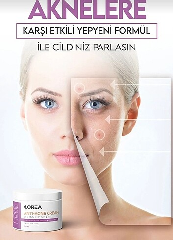 Diğer Sivilce kremi