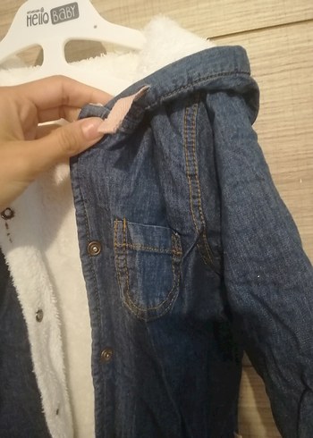 Düğmeli Mavi Bebek Kız Tulumu - Görsel 2