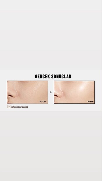 Beden Renk medicube AGE-R BOOSTER PRO