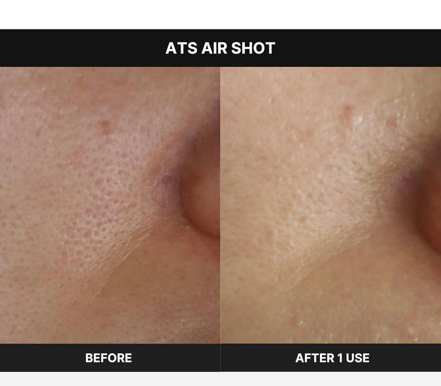 Medicube Age-R ATS Air Shot - Görsel 2