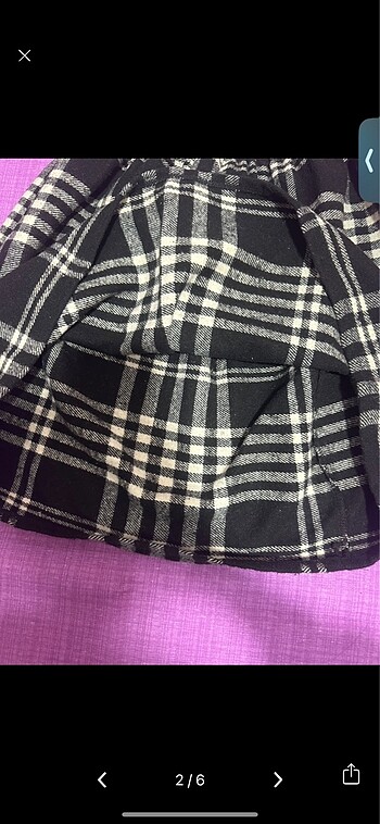 Siyah etek - Görsel 2