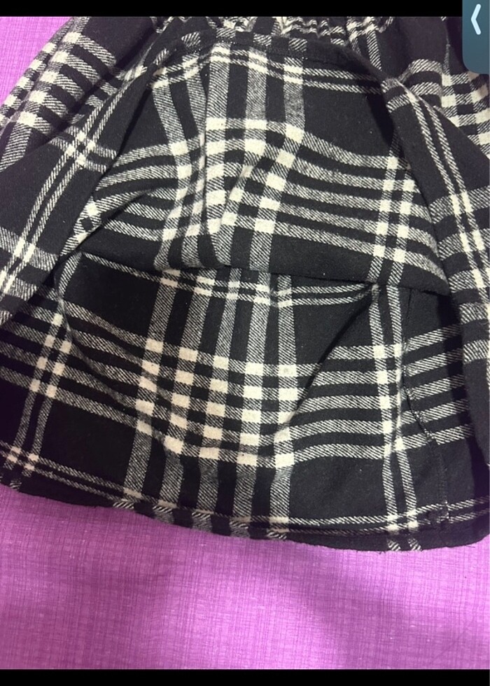 Siyah etek - Görsel 3