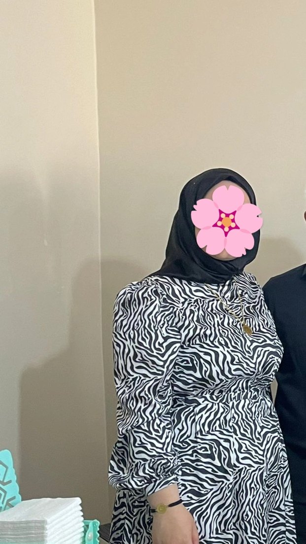 Zebra Desenli Uzun Salaş Elbise - Görsel 2