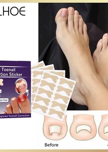 Tırnak düzeltme bandı onlu  - Görsel 3