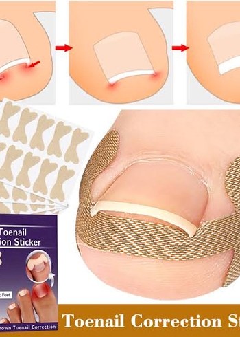 Tırnak düzeltme bandı onlu  - Görsel 2