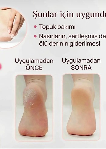 TeknoClass Pedi Elektronik Pedikür Aleti Pembe - Görsel 4