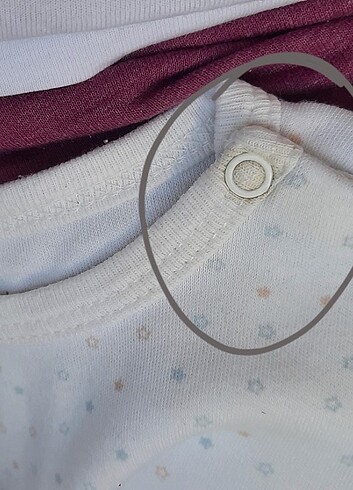 4 parça hastane çıkışı - Görsel 6