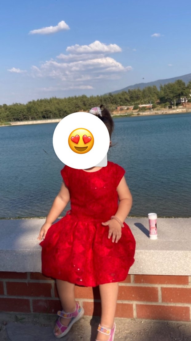 Kız Çocuk  Dantelli elbise - Görsel 4