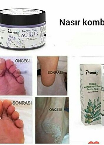  Beden Renk Cilt bakım????