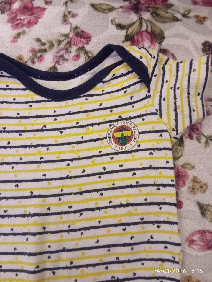 Sarı Çizgili Bebek Body, Kısa Kollu, Düğmeli - Görsel 2