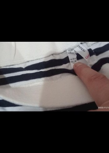 Kız Çocuk Siyah Beyaz Zebra Desenli Pilili Etek - Görsel 3