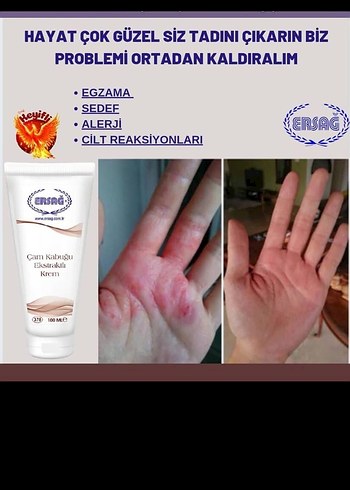 Ürünleri İnceleyin Bilgi İçin Mesaj Atın - Görsel 10