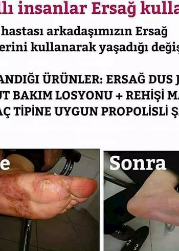 Ürünleri İnceleyin Bilgi İçin Mesaj Atın - Görsel 12