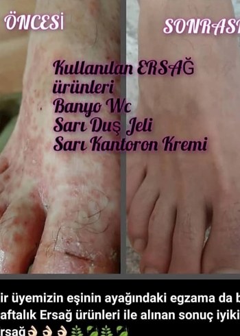 Ürünleri İnceleyin Bilgi İçin Mesaj Atın - Görsel 5