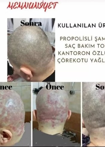 Ürünleri İnceleyin Bilgi İçin Mesaj Atın - Görsel 2