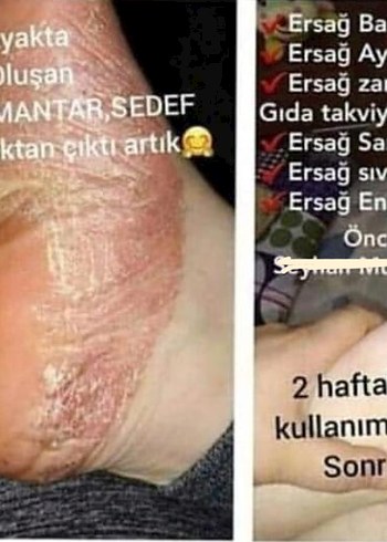 Ürünleri İnceleyin Bilgi İçin Mesaj Atın - Görsel 4