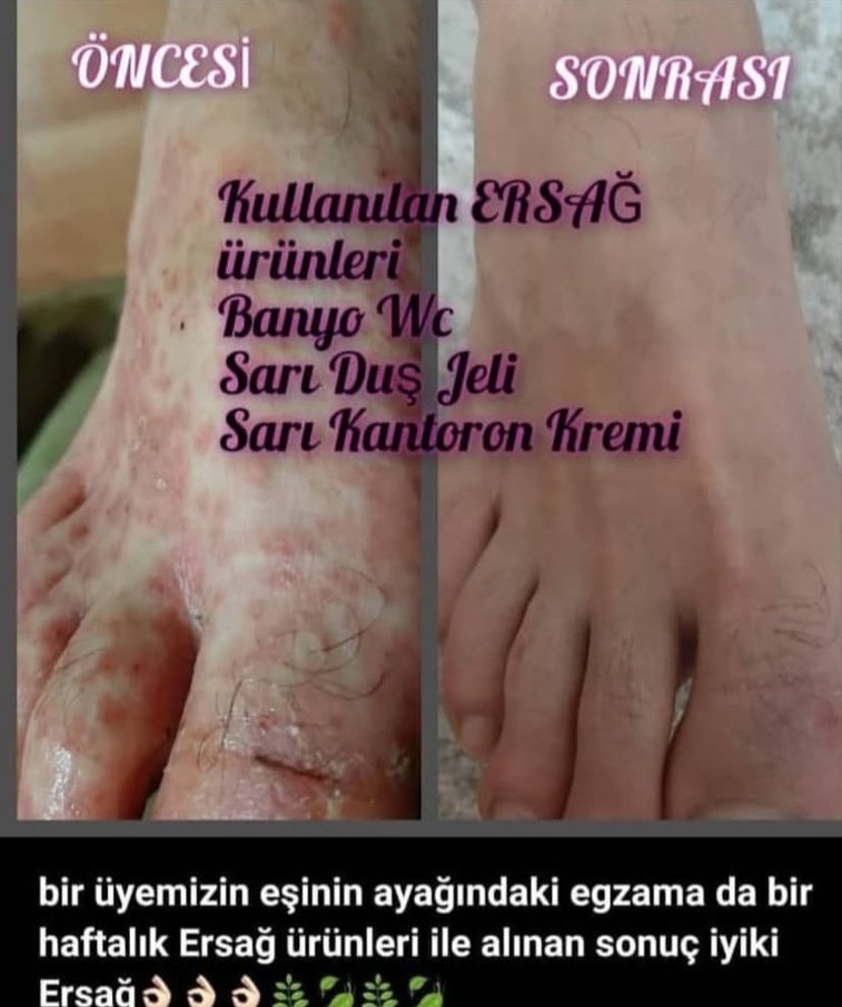 Ürünleri İnceleyin Bilgi İçin Mesaj Atın - Görsel 5