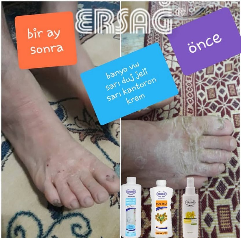 Ürünleri İnceleyin Bilgi İçin Mesaj Atın - Görsel 3