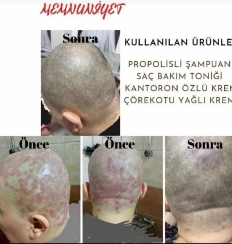 Ürünleri İnceleyin Bilgi İçin Mesaj Atın - Görsel 2