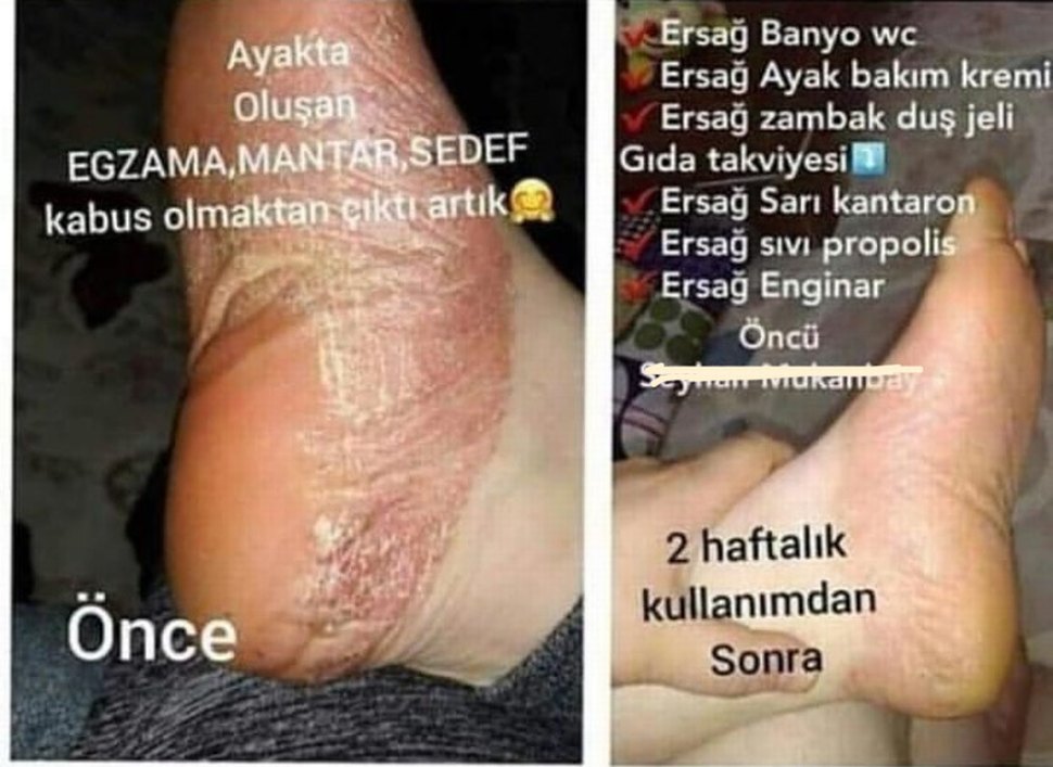 Ürünleri İnceleyin Bilgi İçin Mesaj Atın - Görsel 4