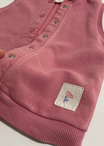 Düğmeli Pembe Kız Çocuk Yeleği - Görsel 2
