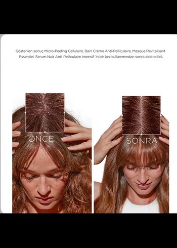 Kérastase Symbiose Kepeğe Karşı Canlandırıcı Saç Maskesi 200 ml - Görsel 4