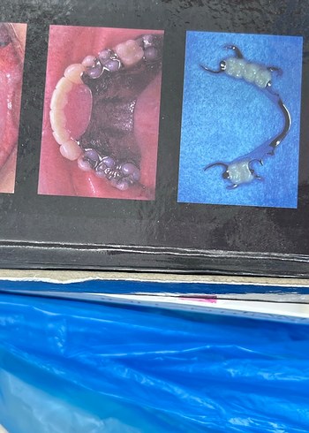 Protezer Klinisyeninin Rehberi - Görsel 2