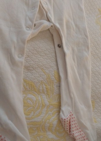 Bebek Erkek Hastane Tulumu Düğmeli Pamuk - Görsel 4