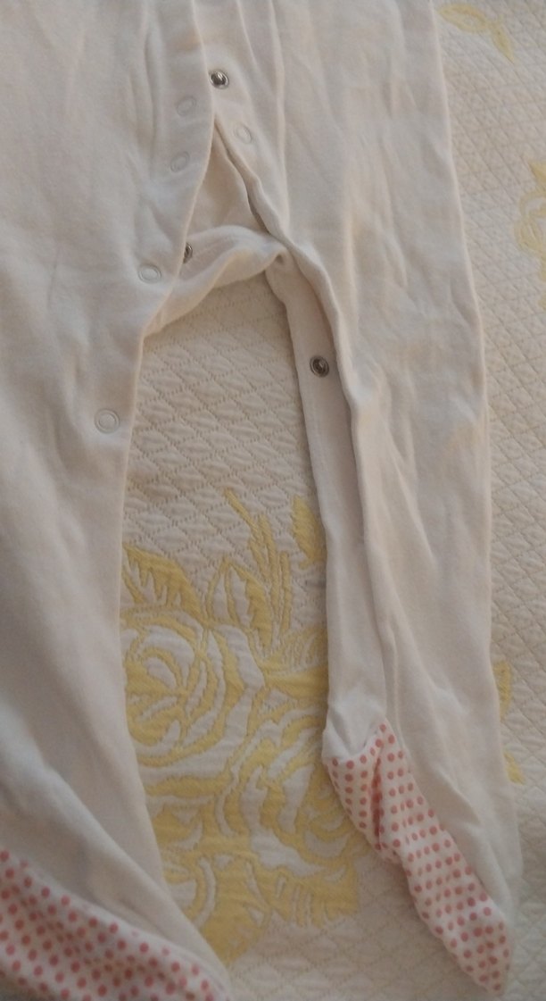 Bebek Erkek Hastane Tulumu Düğmeli Pamuk - Görsel 4