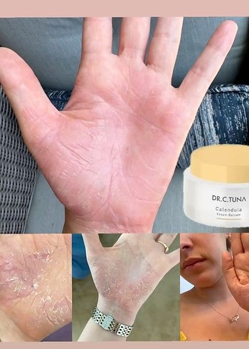 DR.C.TUNA Calendula Krem Balsam - Görsel 2