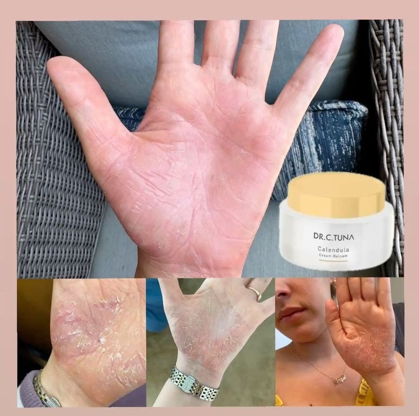 DR.C.TUNA Calendula Krem Balsam - Görsel 2