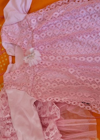 Kız Çocuk Pembe Dantelli V Yaka Elbise - Görsel 2