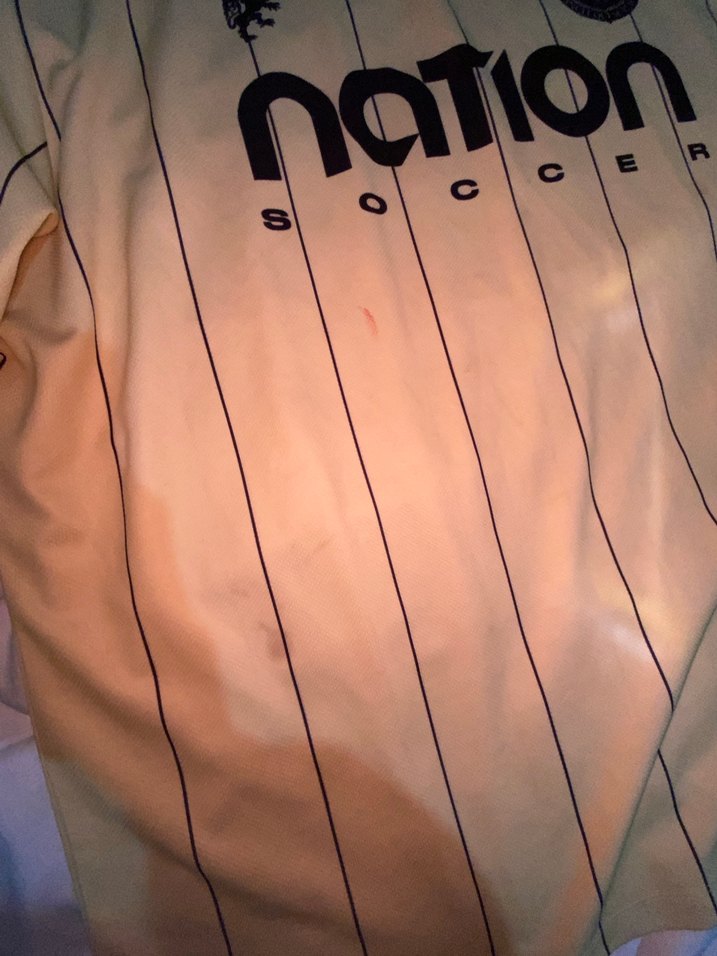 sarı siyah çizgili kadın oversize forma - Görsel 5