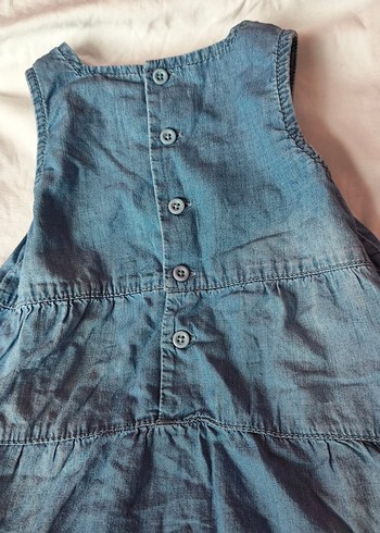 Düğmeli Mavi çocuk elbisesi - Görsel 2