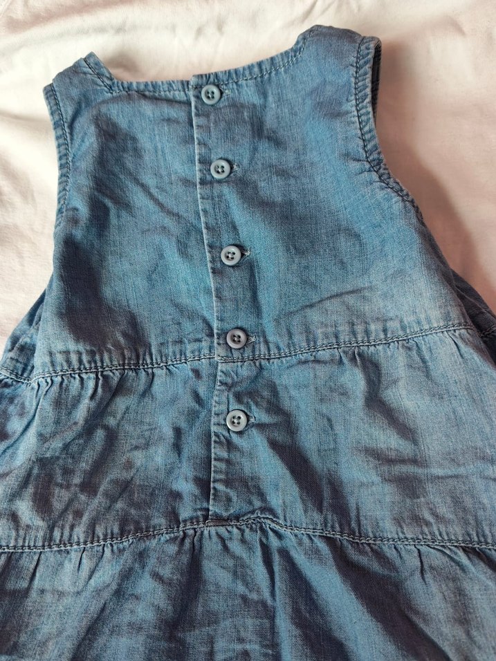 Düğmeli Mavi çocuk elbisesi - Görsel 2