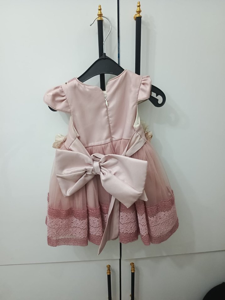 Dantel Detaylı Pembe Kız Çocuk Elbise - Görsel 2