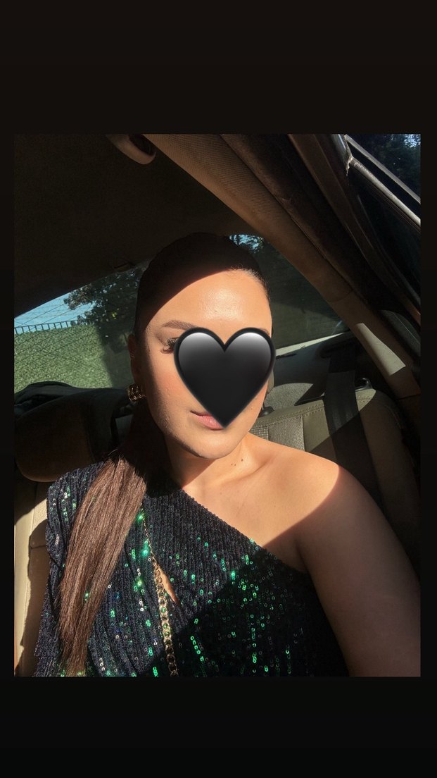 Yeşil pullu mini elbise - Görsel 4