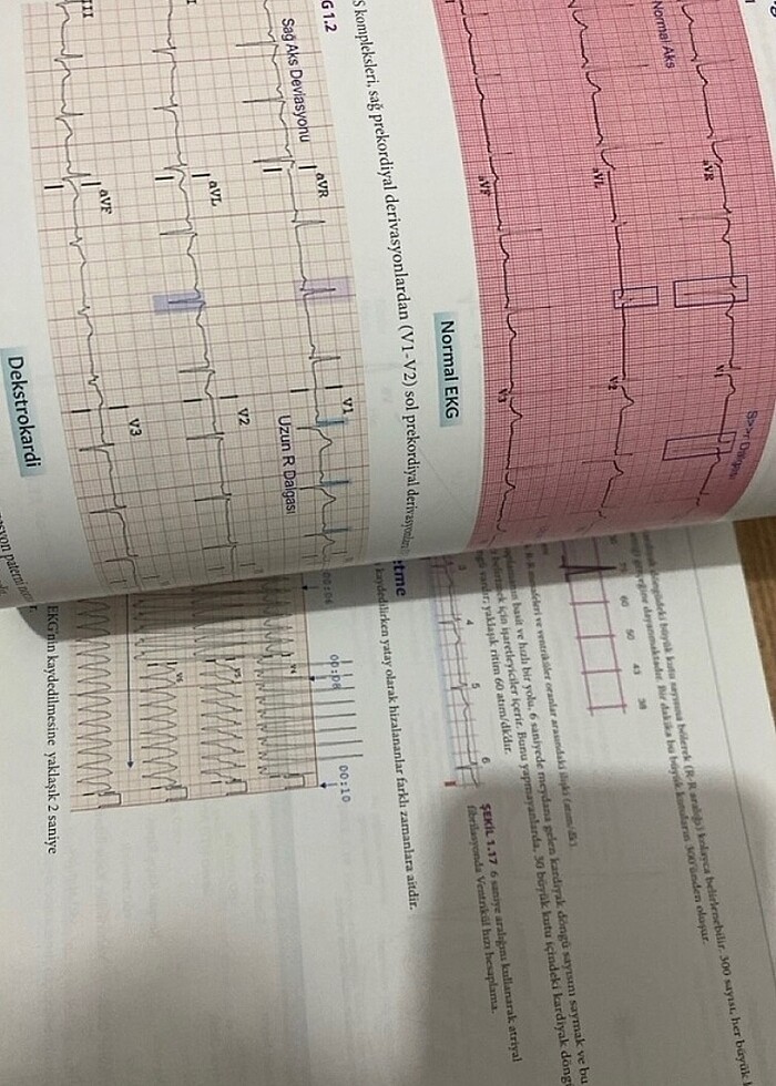 EKG YORUMLANMASINDA BİR GÖRSEL REHBER - Görsel 2