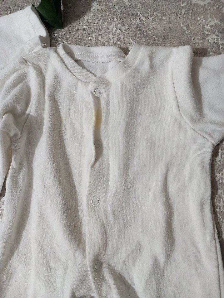 Bebek Erkek Beyaz Hastane Tulumu - Görsel 4