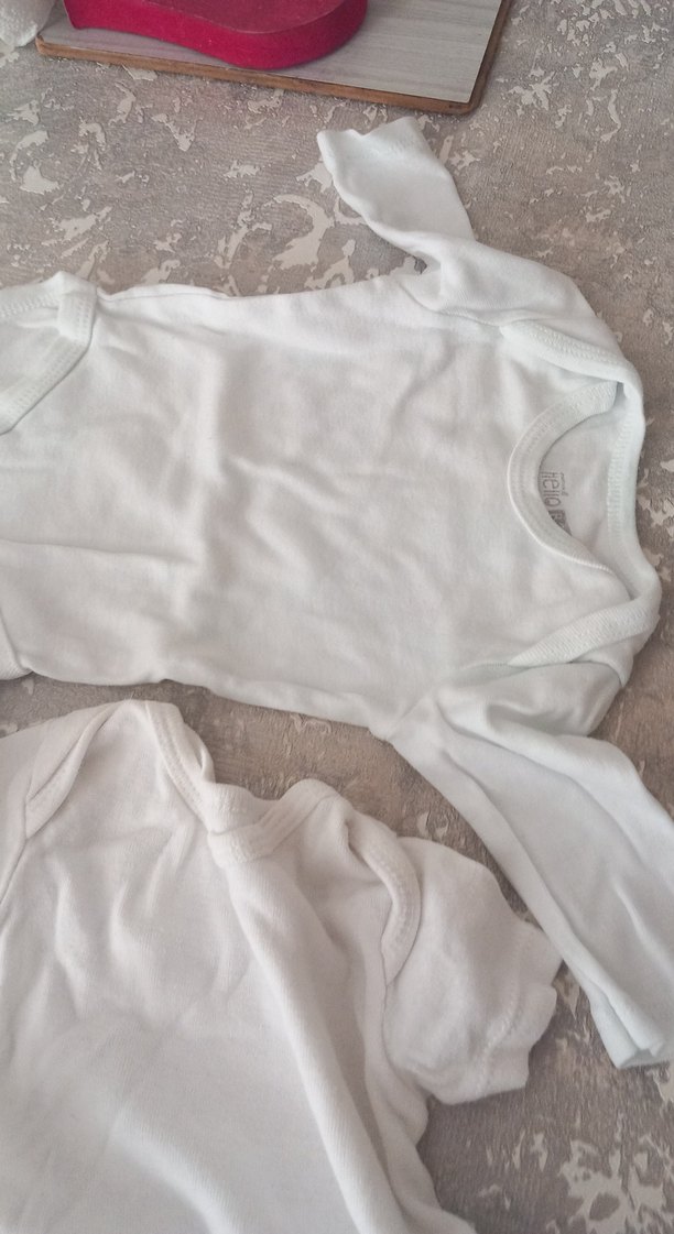 BebekKısa Kollu Beyaz Hastane Tulumu - Görsel 4