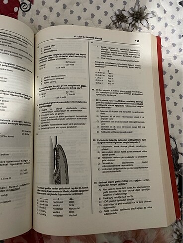  Beden Renk Denttest 12