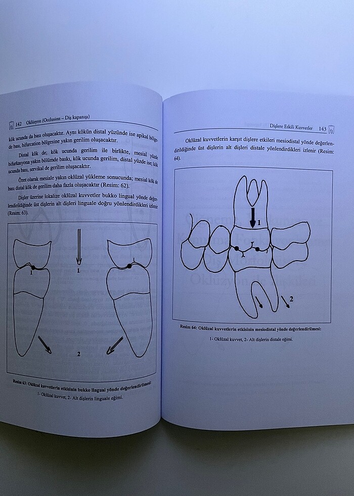 Oklüzyon - Görsel 2