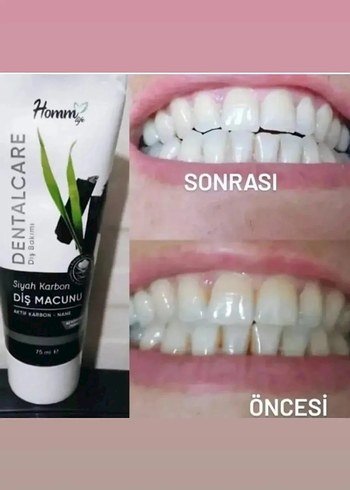 Diger Siyah Karbon Diş Macunu 75 ml