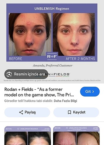 Rodan fıelds maske u.s.a