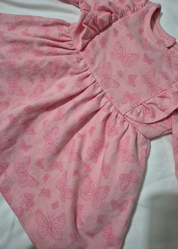 Pembe Kelebek Baskılı Kız Çocuk Elbise - Görsel 3