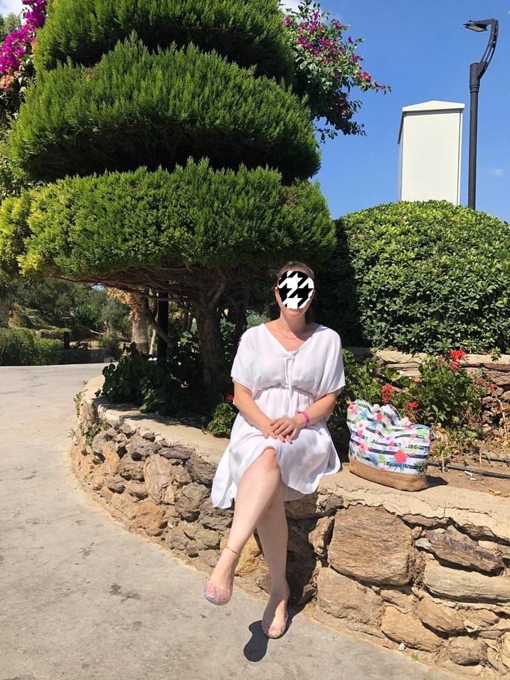 Plaj elbisesi Tunik Elbise - Görsel 2